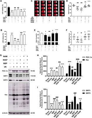 Neuroprotection of NAD+ and NBP against ischemia/reperfusion brain injury is associated with restoration of sirtuin-regulated metabolic homeostasis